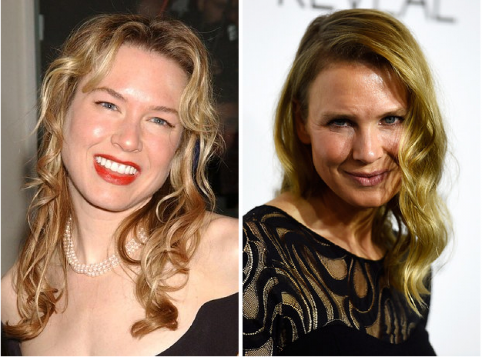 Renée Zellweger antes y después Soy