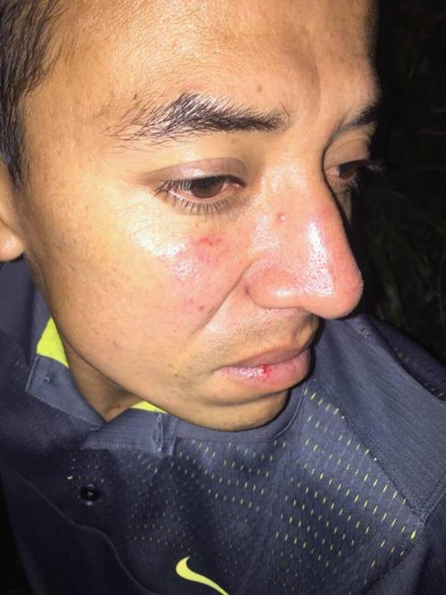 Jerónimo López, asistente 1, recibió varios golpes en el rostro según la denuncia de la AGAF. (Foto: Cortesía)