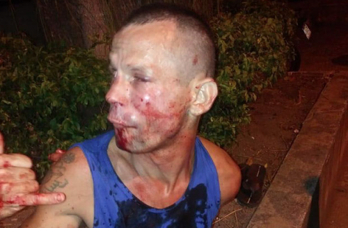 El hombre quedó muy lastimado debido a la acción de la peleadora. (Foto: MMA Junkie)