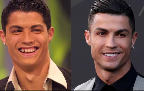 Cristiano Ronaldo tenía una separación significativa en sus dientes. (Foto: Telemundo) 