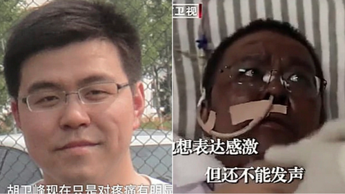 El drástico cambio del color de piel del médico Hu Weifeng. (Foto: Captura de pantalla) 