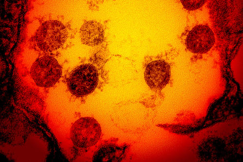 Coronavirus bajo el microscopio. (Foto: UCSF)