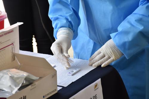 Las pruebas de antígeno o rápidas se repartirán a partir de este viernes a nivel nacional. (Foto: MPSAS)