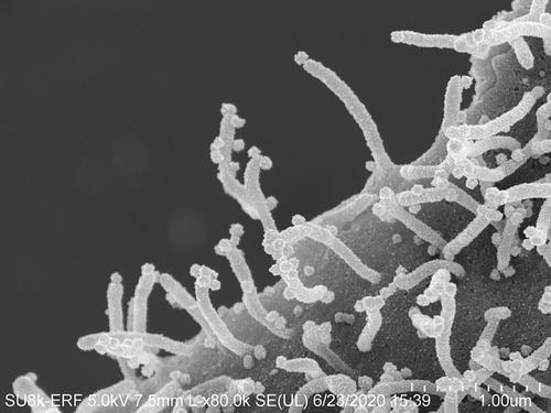 Ataque coronavirus en el cuerpo. (Foto: UC San Francisco)