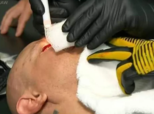 Aún se desconoce si la lesión es parte del evento. (Foto: WWE)
