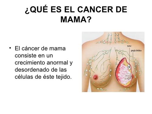 cáncer de mama, cáncer, día mundial del cancer de mama, incan, miguel garcés, karen girón, oncólogos, guatemala, soy502