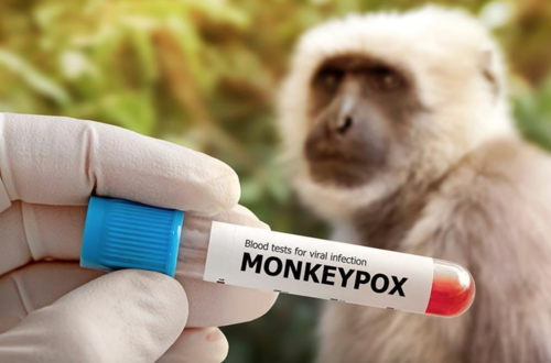 La viruela del mono se ha esparcido en varios países alrededor del mundo. (Foto: Shutterstock)
