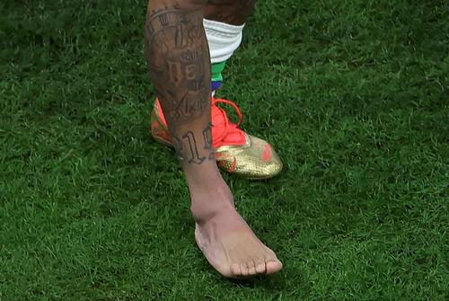 Así quedó el tobillo del jugador brasileño. (Foto: AFP)
