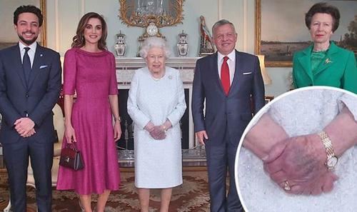 En el detalle se puede ver una coloración oscura en la mano de la reina Isabel II. (Foto: Daily Express)