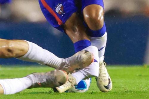 Un fotógrafo logró captar la magnitud de la lesión que mandó al jugador al hospital. 