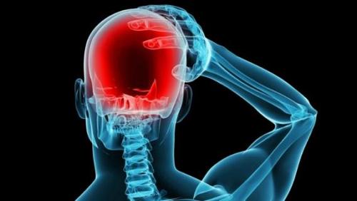 Una migraña es un dolor de cabeza intenso. Su recurrencia afecta seriamente la calidad de vida. (Foto: Getty)