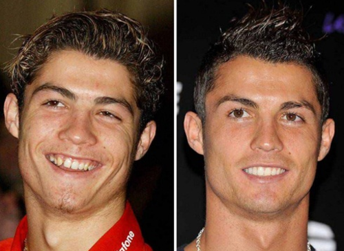 Cristiano Ronaldo, antes (en el Manchester United, cuando tenía 18 años) y ahora. (Fotos: Twitter)