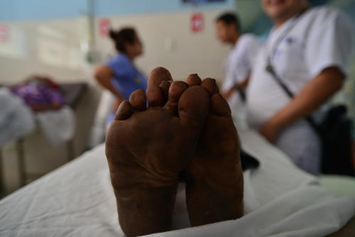 La mayoría de pacientes que acuden al hospital regional de Cuilapa, Santa Rosa son de escasos recursos. (Foto: Wilder López/Soy502)
