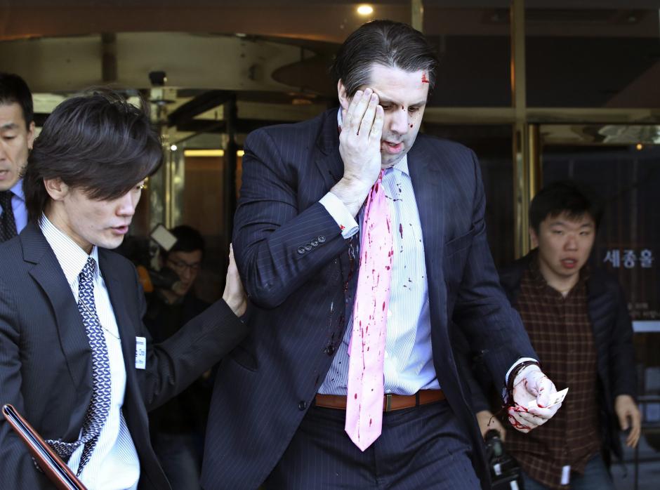 El embajador tuvo que ser intervenido en el brazo en un hospital de Seúl. (Foto: EFE)