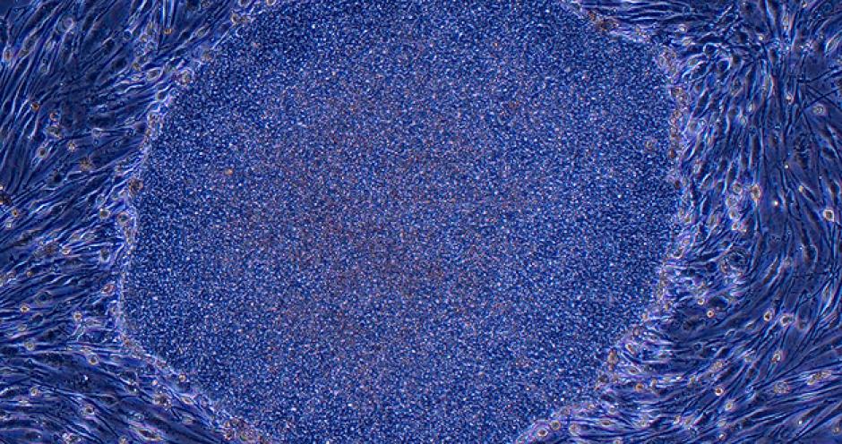 Gobierno pidió al laboratorio Riken, &nbsp;que investigue a fondo un estudio sobre células madre puesto en duda recientemente.