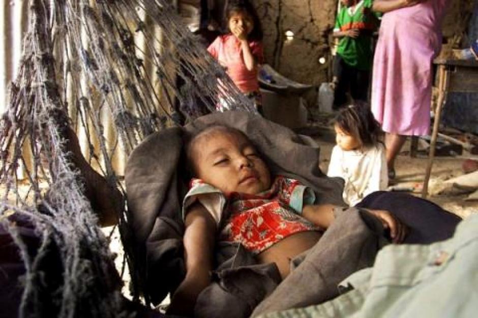 El Gobierno registró el fallecimiento de 110 menores por desnutrición. (Foto: Archivo/Soy502)