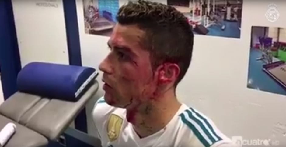 Así fue atendido por el médico en el vestuario del Real Madrid. (Foto: captura de video)&nbsp;