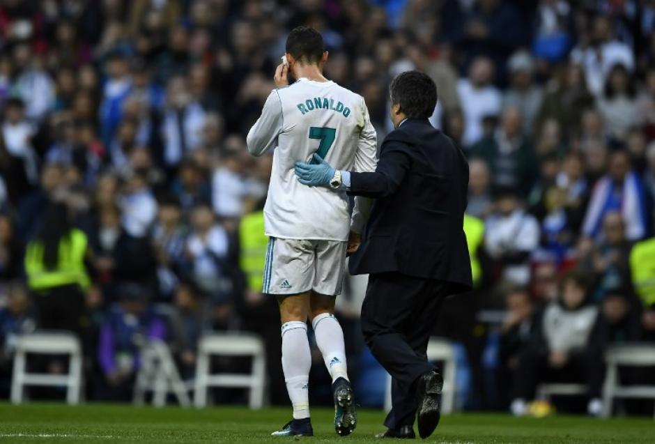 Cristiano Ronaldo reapareció en el entreno del Real Madrid, pero debido a la hinchazón en el rostro no jugará el partido de vuelta de la Copa del Rey. (Foto: AFP)