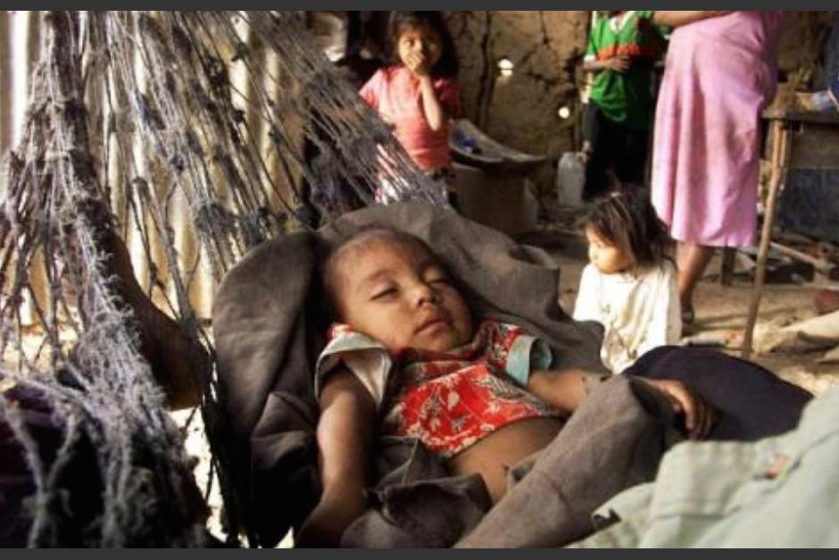 La desnutrición crónica condena a miles de niños a ser pobres. (Foto: Archivo Soy502)