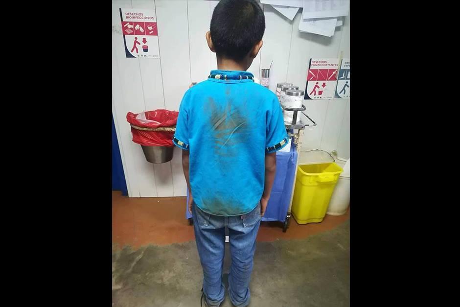 Un niño habría sido víctima de violencia por parte de un maestro de la Escuela Oficial Rural Mixta de Tactic, Alta Verapaz. (Foto: Facebook)