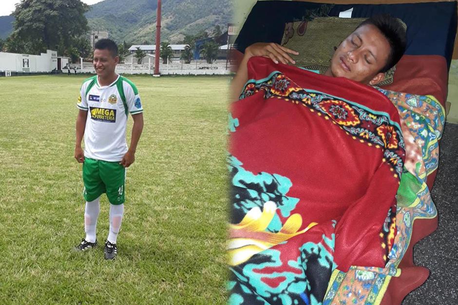El futbolista Kerlin Catún permanecerá en el Hospital Nacional de Cobán por, al menos, dos semanas. (Fotos: FC Ixcán)