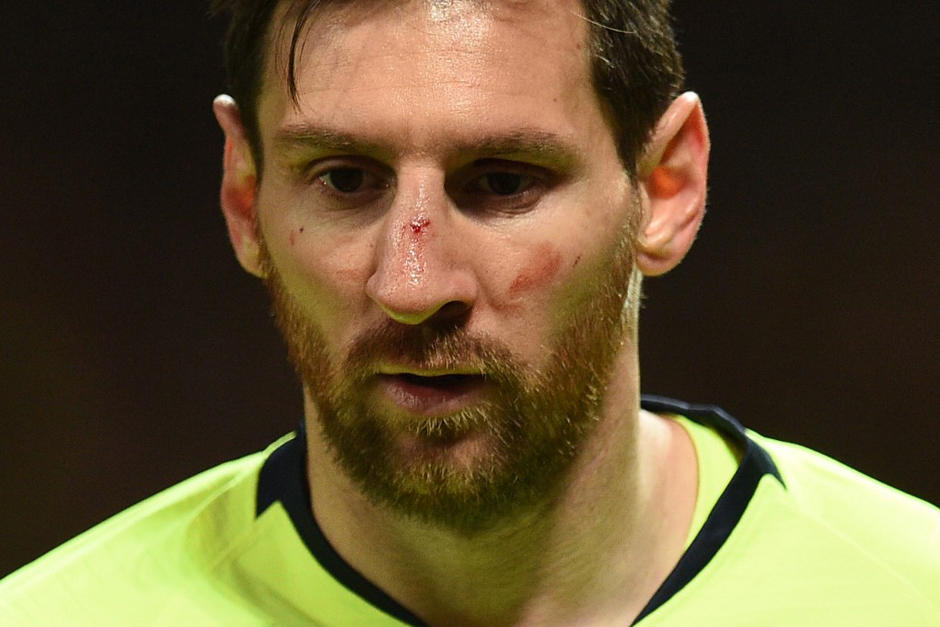 Messi tuvo un sangrado de nariz tras una jugada. (Foto: AFP)