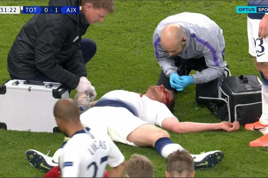 Un terrible choque dejó a Jan Vertonghen fuera de la semifinal. (Foto: Captura de video)