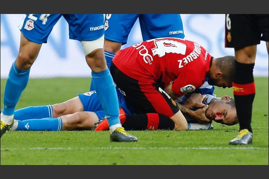 Alex Bergantiños del Deportivo La Coruña necesitó 70 puntos de sutura tras recibir una brutal patada en la boca. (Foto: Partidazo de Cope)