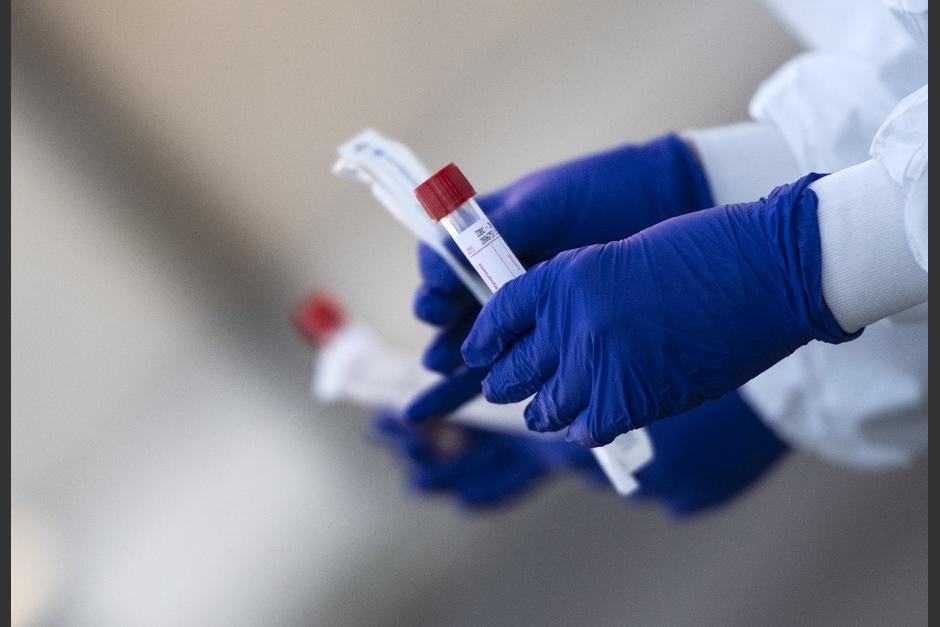 El Laboratorio Nacional de Salud puede hacer al día 200 pruebas de coronavirus. (Foto: AFP)&nbsp;