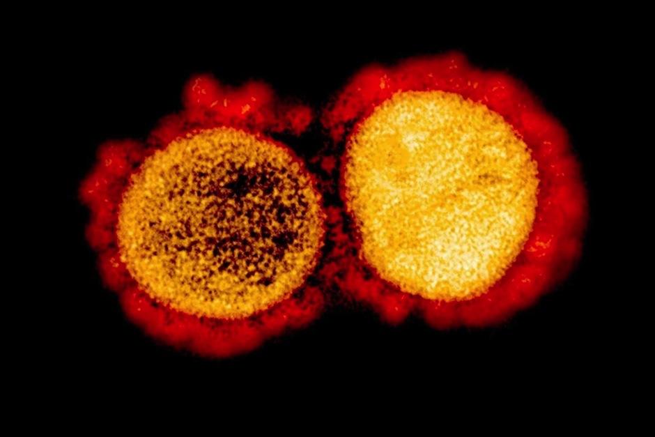 Investigadores descubrieron la vulnerabilidad de la proteína Spike del coronavirus. (Foto: AFP)&nbsp;