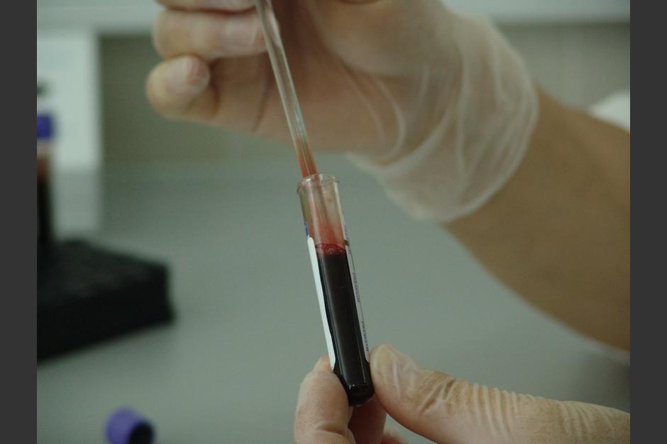 Pacientes con grupo sanguíneo O podrían ser más resistenten al Covid-19. (PxHere)