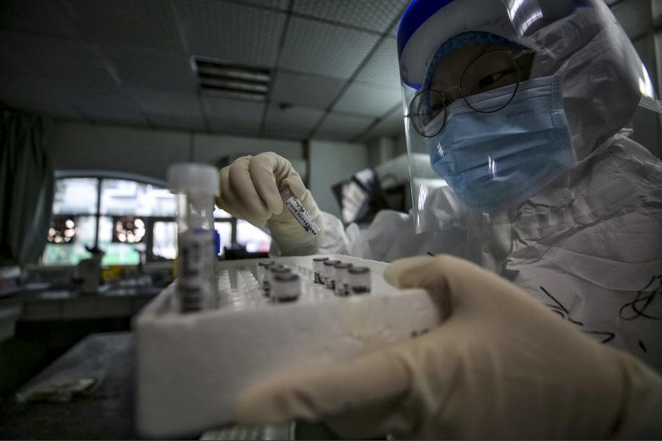La OMS quiere encontrar el causante de la propagación del virus que ha puesto al mundo de rodillas. (Foto: AFP)