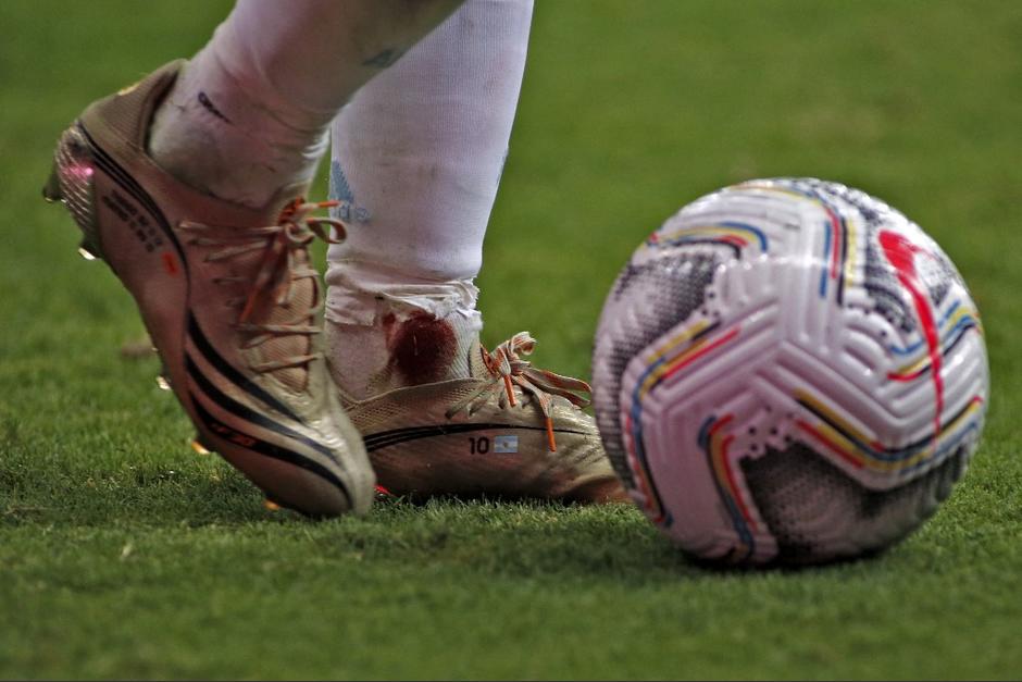 El tobillo de Lionel Messi quedó seriamente afectado tras una falta, pero no le impidió concluir el juego. Foto: AFP)