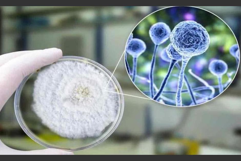 El hongo negro afecta gravemente a personas con el sistema inmunológico bajo. (Foto: Medicina y Salud)