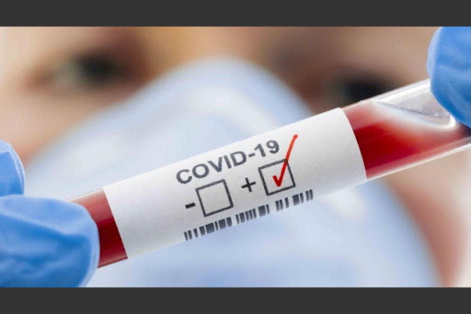 El Covid-19 puede producir síntomas diferentes en cada personas. (Foto: servicios)