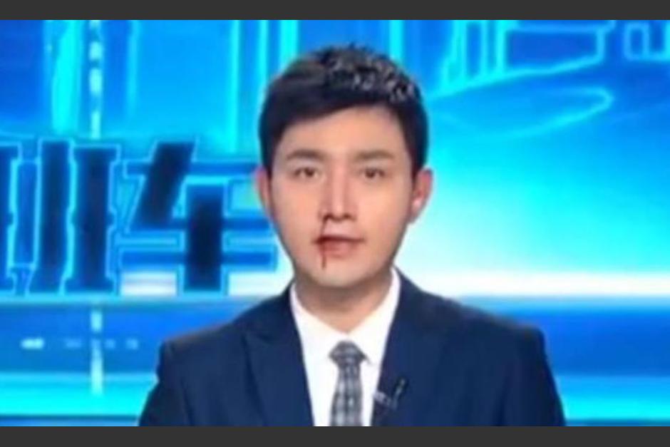 Un presentador de televisión en China sufrió una hemorragia durante programa en vivo. (Foto: LaPatilla)