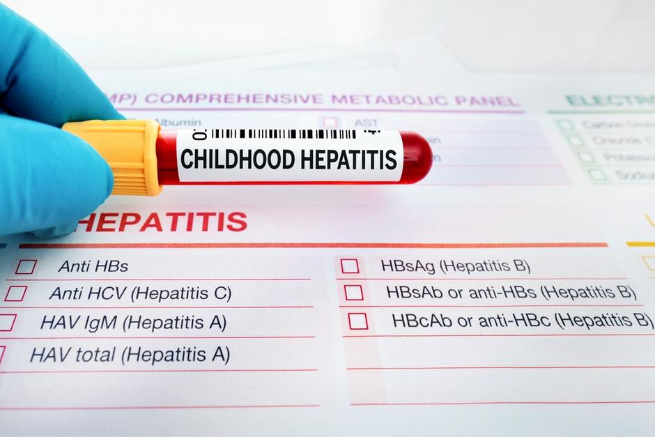 A finales de abril, la OMS confirmó la primera muerte de un niño con hepatitis aguda grave. (Foto: Shutterstock)