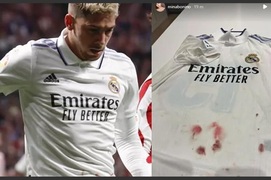 La camisa de Valverde terminó con manchas de sangre tras el derbi ante el Atlético. (Foto: Redes sociales)