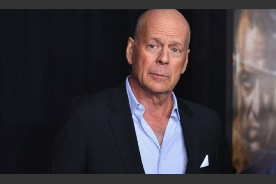 Bruce Willis fue diagnosticado con demencia frontotemporal. (Foto: Tikitakas)