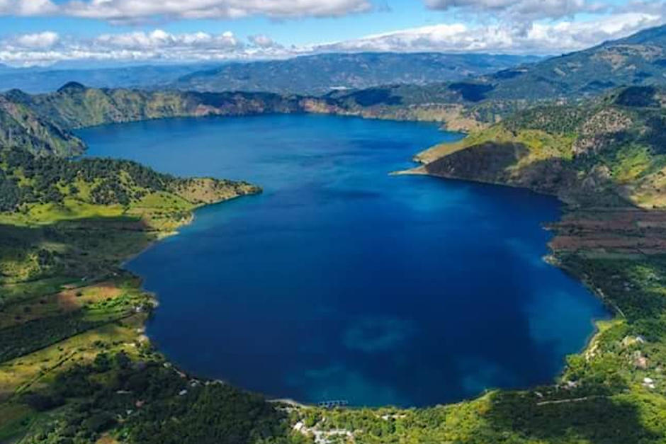 la laguna de Ayarza cuenta con misterios bajo el fondo. Foto: Juan Pablo Palacios Altan.&nbsp;