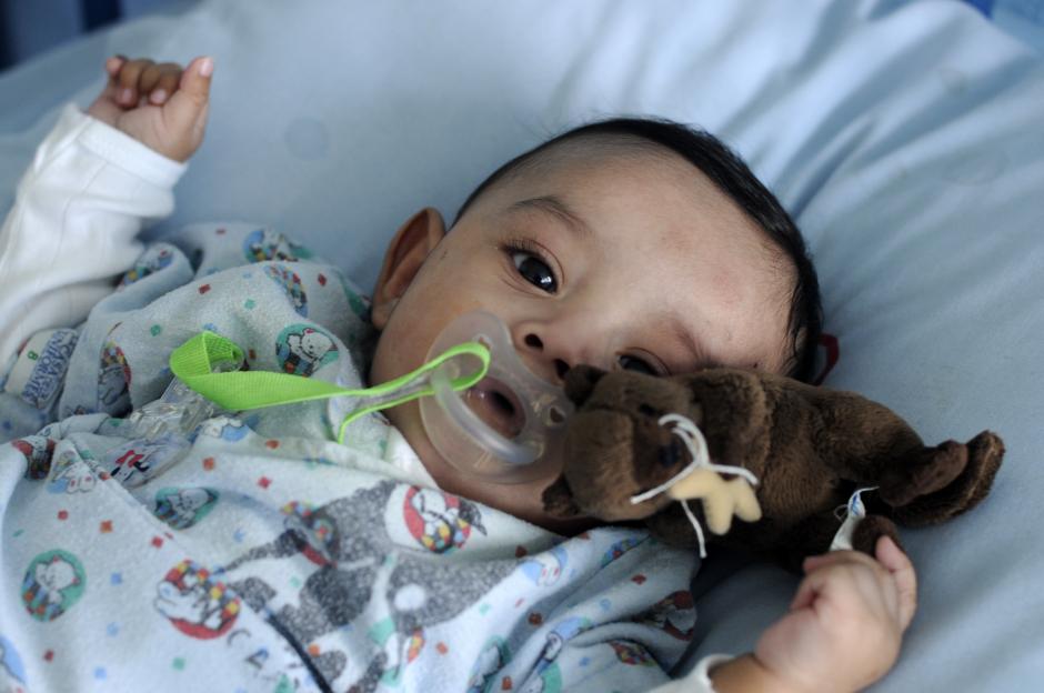 Diego es un bebé de 6 meses que fue sometido a una operación a corazón abierto y se encuentra ya en una recuperación exitosa. (Foto: Esteban Biba/Soy502)