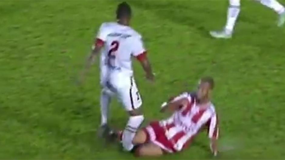 El futbolistas brasileño, Bruno Moura, sufrió una dolorosa fractura de tibia y peroné.