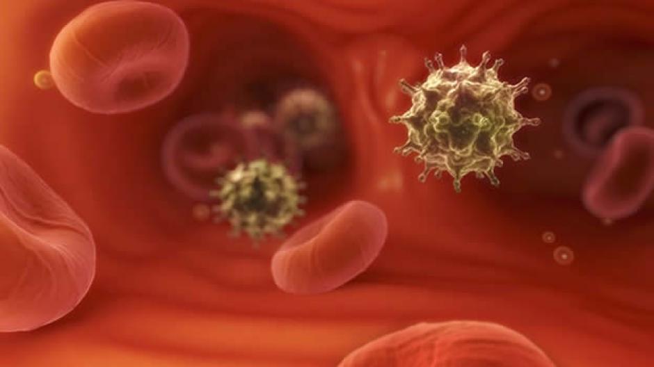 Las diferencias entre el Virus de Inmunodeficiencia Adquirida (VIH) y el Síndrome de Inmunodeficiencia Adquirida (SIDA). (Foto:mexico.cnn.com)&nbsp;