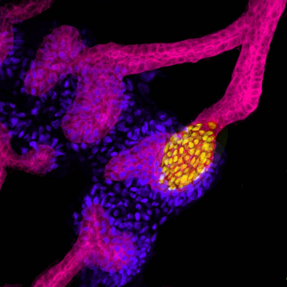Primordio de riñón obtenido en el laboratorio de Juan Carlos Izpisúa a partir de células madre humanas. En amarillo, marca las células humanas que se han diferenciado a células precursoras del sistema colector renal.