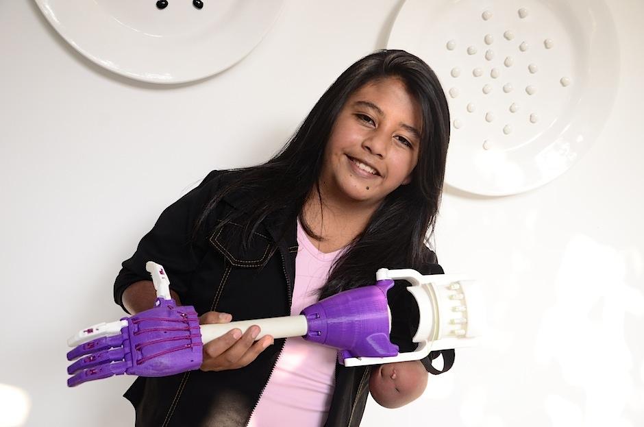 La primera prótesis 3D realizada en Guatemala beneficiará a muchos. (Foto: Selene Mejía/Soy502)&nbsp;