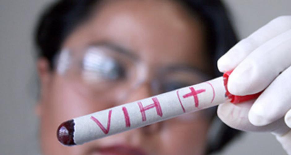 La administración de un anticuerpo llamado 3BNC117 reduce la carga viral del VIH. (Foto 1070Noticias)