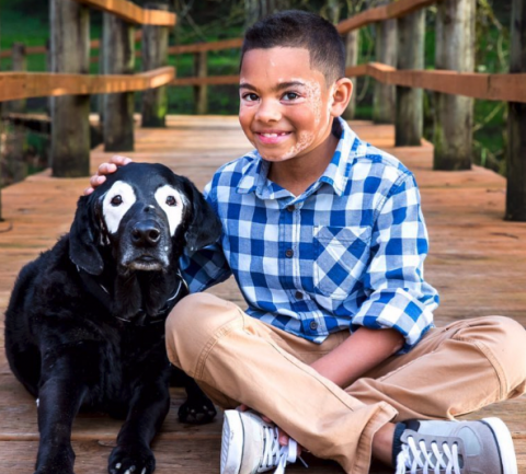 Tierna historia de niño y perrito que luchan contra el vitiligo