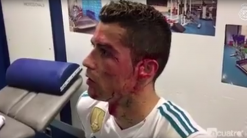 El día después: así quedó la herida de Cristiano Ronaldo