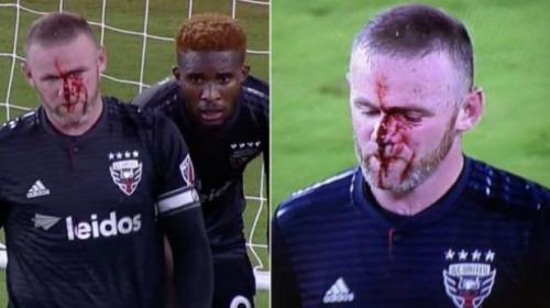 Primer gol y rostro con sangre de Wayne Rooney en la MLS