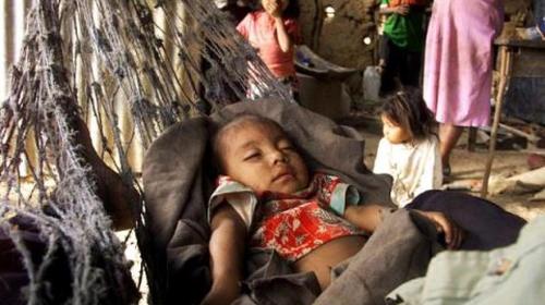 Desnutrición: Alimentar a las niñas no es prioridad en Guatemala